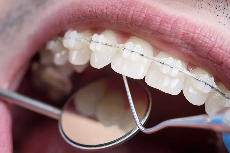 bg_img_home_homenew_block2-5_lj